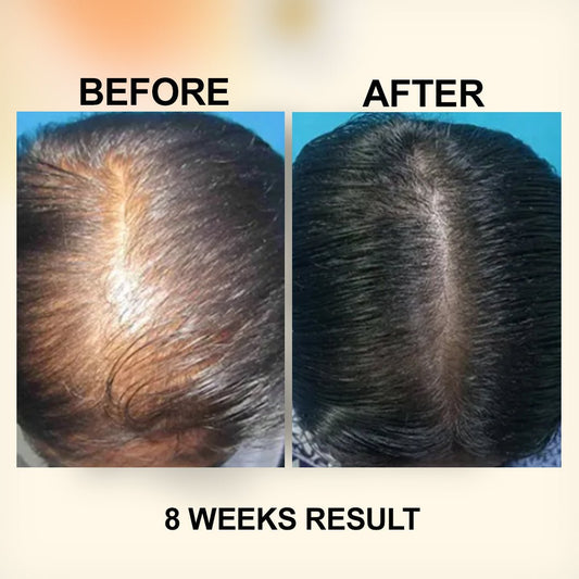 Zubila Organic Hair Oil - Zubila