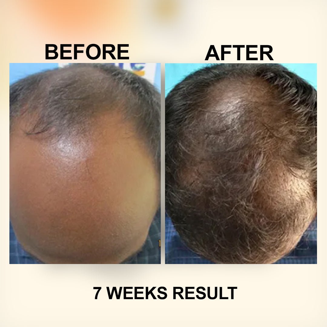 Zubila Organic Hair Oil - Zubila