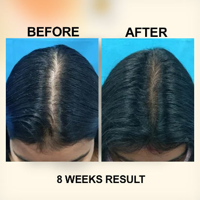 Zubila Organic Hair Oil - Zubila