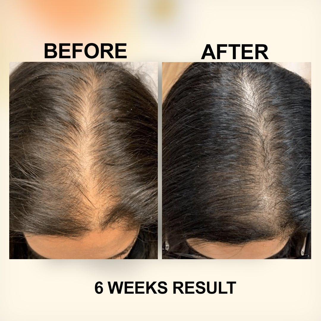 Zubila Organic Hair Oil - Zubila